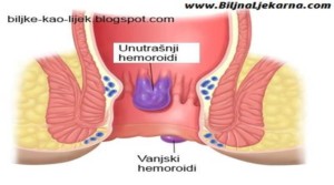 hemoroidi Biljna Ljekarna